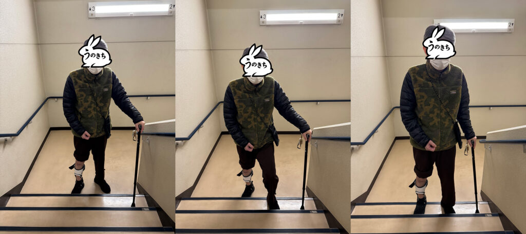 脳梗塞後の片麻痺リハビリで階段を杖と装具を使って昇り降りする様子