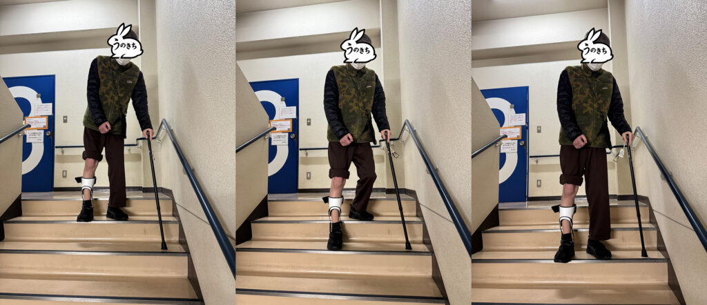 脳梗塞後の片麻痺リハビリで階段を杖と装具を使って昇り降りする様子