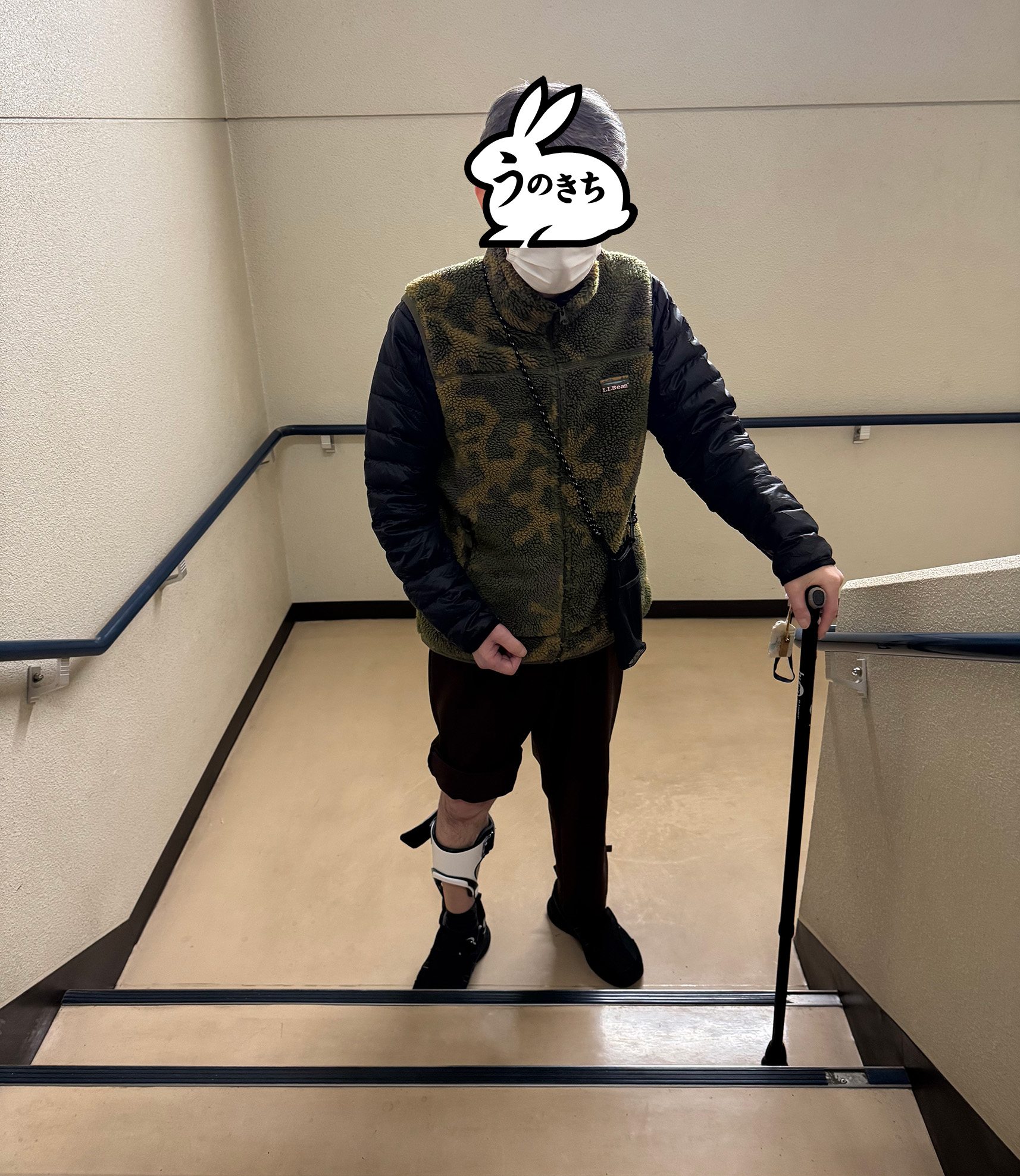 脳梗塞後の片麻痺リハビリで階段を杖と装具を使って昇り降りする様子