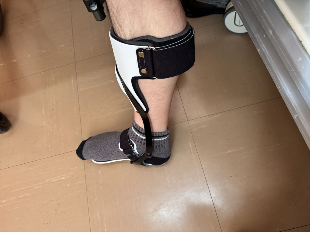 ゲイトソリューションデザイン(GAITSOLUTION Design)を右脚に装着した回復期リハビリ中の様子